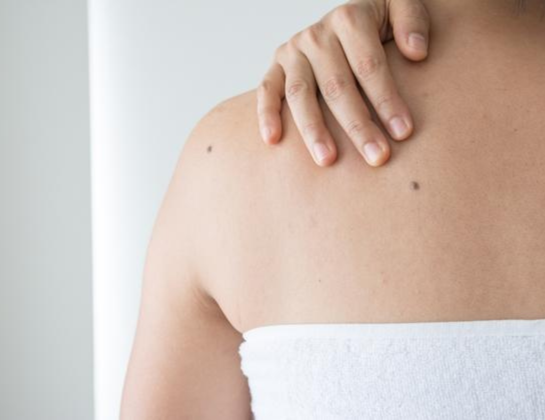 moles-warts-tags treatment near siddipet Best moles-warts-tags treatment near siddipet